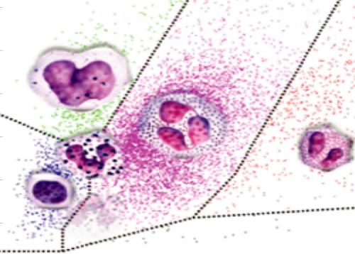 What Is The Difference? 3 Part And 5 Part Hematology Analyzer 