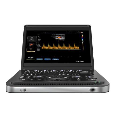 Advanced Color Doppler Ultrasound Technology in 2026: A Complete Clinical Guide