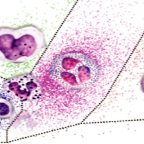 What Is The Difference? 3 Part And 5 Part Hematology Analyzer 