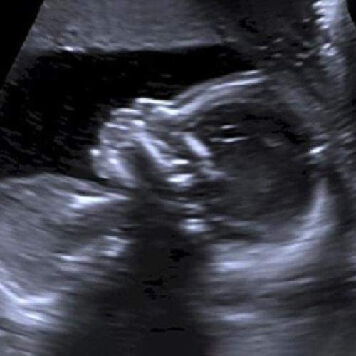 What Are The Different Ultrasound Probes Used For?