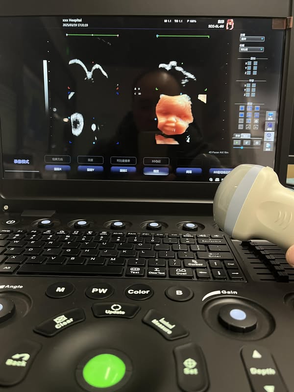 Hawmed 4D Ultrasound.jpg