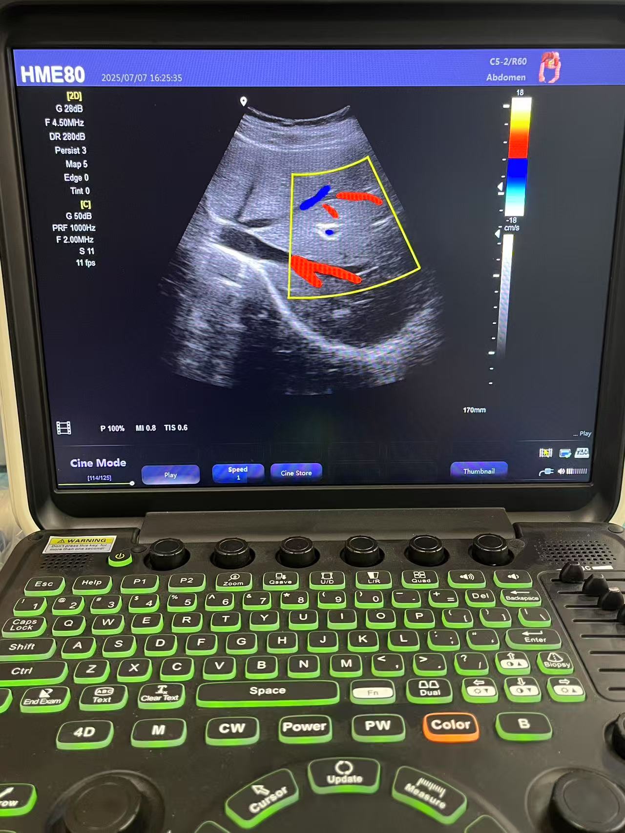 Hawmed HME80 Color Cardiac Ultrasound for Our Côte d'Ivoire.jpg