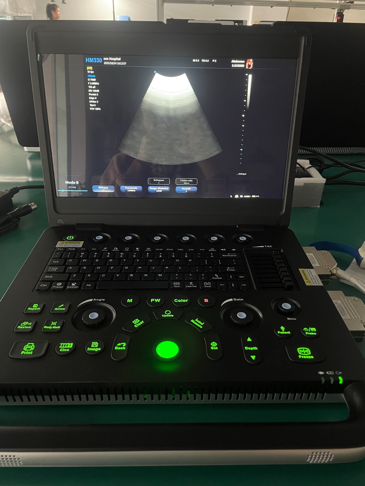 Hawmed HM330 Color Doppler Ultrasound Shipped to Our Venezuela Partner.jpg Hawmed HM330 Color Doppler Ultrasound Shipped to Our Venezuela Partner.jpg
